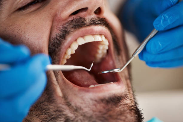 Best Mobile Emergency Dentist in Harb, OR