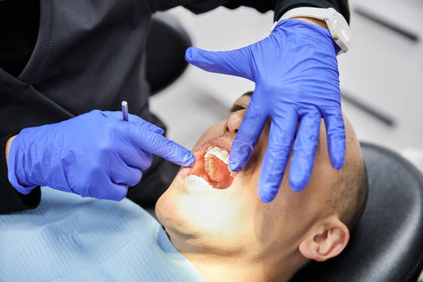 Best Emergency Dentist for Knocked-Out Tooth in Harb, OR